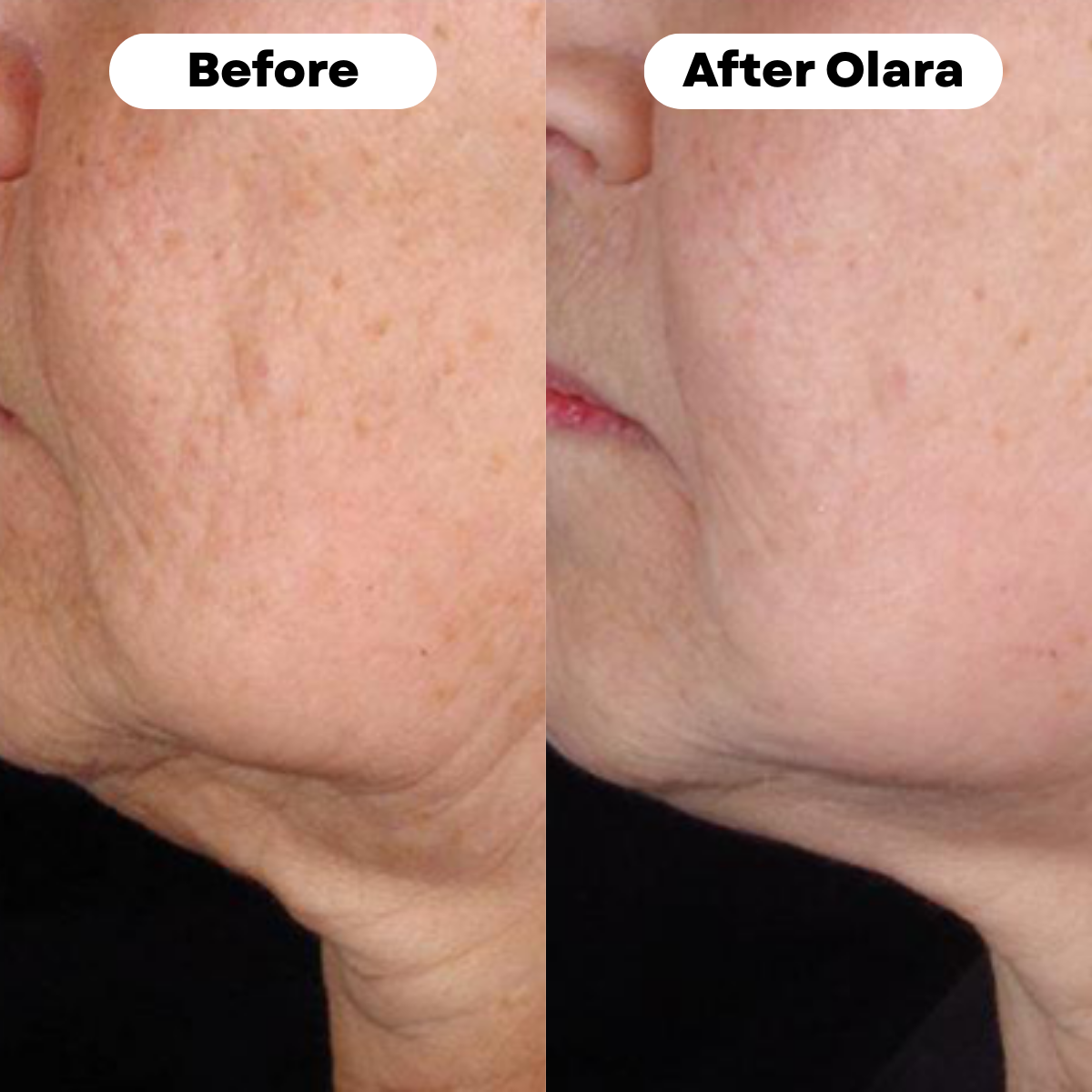 NAD+ Advanced for Women | Powered by Selerb™