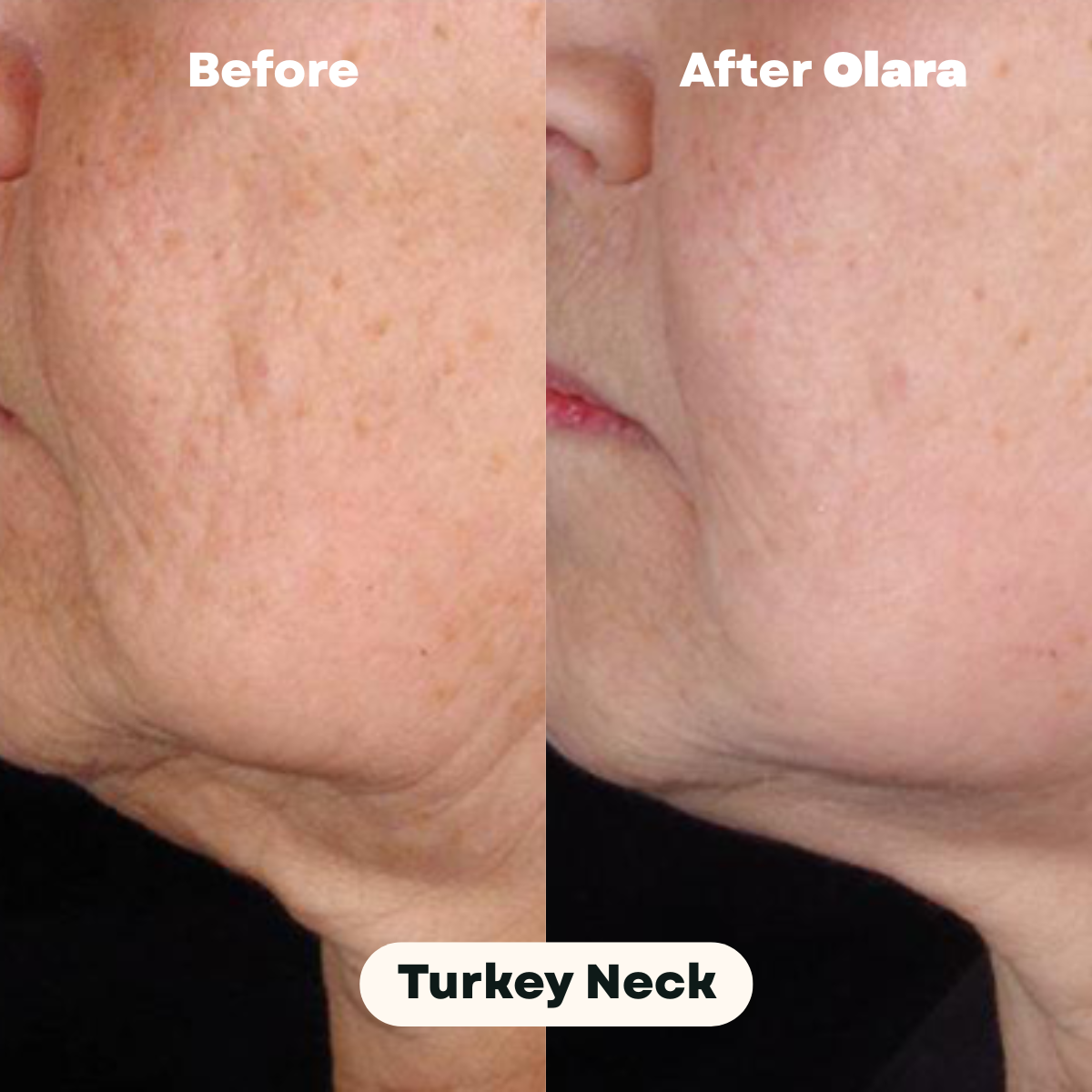 OLARA™ NMN Capsules